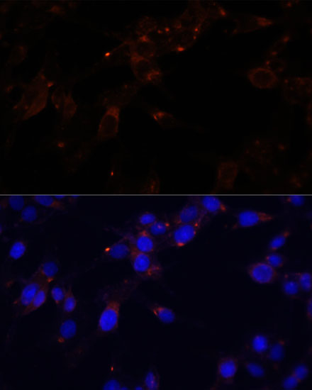 Immunofluorescence analysis of HeLa cells using CD44 Polyclonal Antibody at dilution of  1:100. Blue: DAPI for nuclear staining.