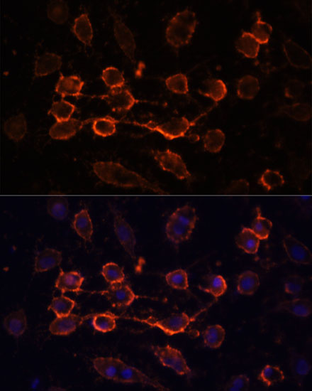 Immunofluorescence analysis of HUVEC cells using CD44 Polyclonal Antibody at dilution of  1:100. Blue: DAPI for nuclear staining.