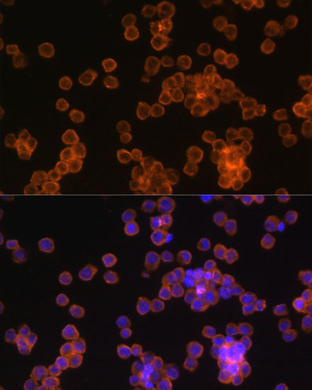 Immunofluorescence analysis of Raw264.7 cells using CD44 Polyclonal Antibody at dilution of  1:100. Blue: DAPI for nuclear staining.