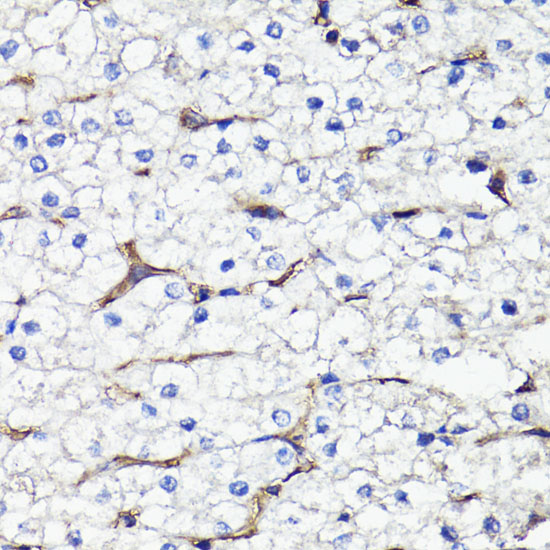 Immunohistochemistry of paraffin-embedded Human liver using CD44 Polyclonal Antibody at dilution of  1:100 (40x lens).