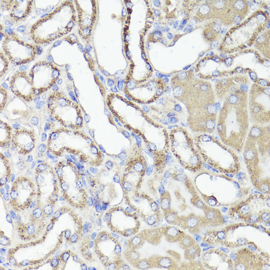 Immunohistochemistry of paraffin-embedded Mouse kidney using CD44 Polyclonal Antibody at dilution of  1:100 (40x lens).