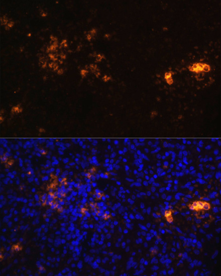 Immunofluorescence analysis of Rat spleen using CD70 Polyclonal Antibody at dilution of  1:100. Blue: DAPI for nuclear staining.