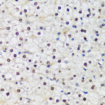 Immunohistochemistry of paraffin-embedded Human liver using DNMT1 Polyclonal Antibody at dilution of  1:200 (40x lens).