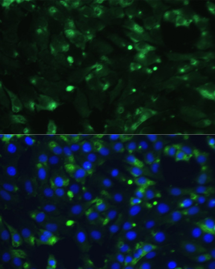 Immunofluorescence analysis of C6 cells using ENO1 Polyclonal Antibody at dilution of  1:100. Blue: DAPI for nuclear staining.