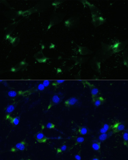 Immunofluorescence analysis of NIH-3T3 cells using ENO1 Polyclonal Antibody at dilution of  1:100. Blue: DAPI for nuclear staining.