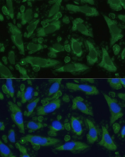 Immunofluorescence analysis of U-2 OS cells using ENO1 Polyclonal Antibody at dilution of  1:100. Blue: DAPI for nuclear staining.