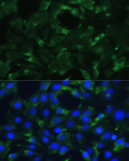 Immunofluorescence analysis of C6 cells using ENO1 Polyclonal Antibody at dilution of  1:100. Blue: DAPI for nuclear staining.