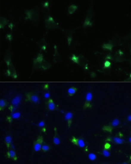 Immunofluorescence analysis of NIH-3T3 cells using ENO1 Polyclonal Antibody at dilution of  1:100. Blue: DAPI for nuclear staining.