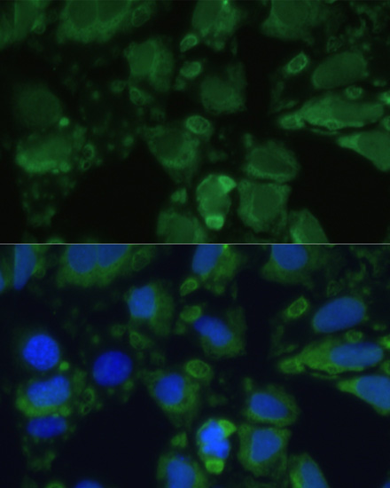 Immunofluorescence analysis of U-2 OS cells using ENO1 Polyclonal Antibody at dilution of  1:100. Blue: DAPI for nuclear staining.