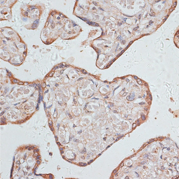 Immunohistochemistry of paraffin-embedded Human placenta using GAB1 Polyclonal Antibody at dilution of  1:100 (40x lens).