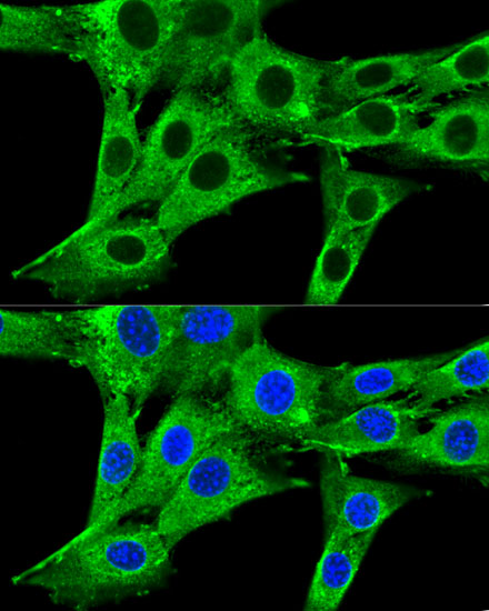 Confocal immunofluorescence analysis of NIH-3T3 cells using HMGCR Polyclonal Antibody at dilution of  1:200. Blue: DAPI for nuclear staining.