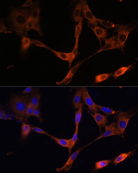 Immunofluorescence analysis of NIH/3T3 cells using HMGCR Polyclonal Antibody at dilution of  1:100. Blue: DAPI for nuclear staining.