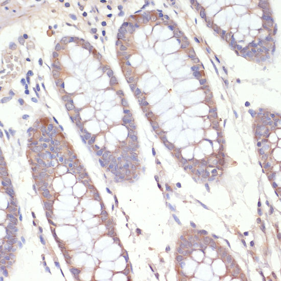Immunohistochemistry of paraffin-embedded Human colon using HMGCR Polyclonal Antibody at dilution of  1:200 (40x lens).