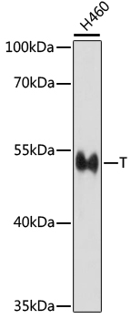 Western blot analysis of extracts of H460 cells using T Polyclonal Antibody at dilution of 1:1000.