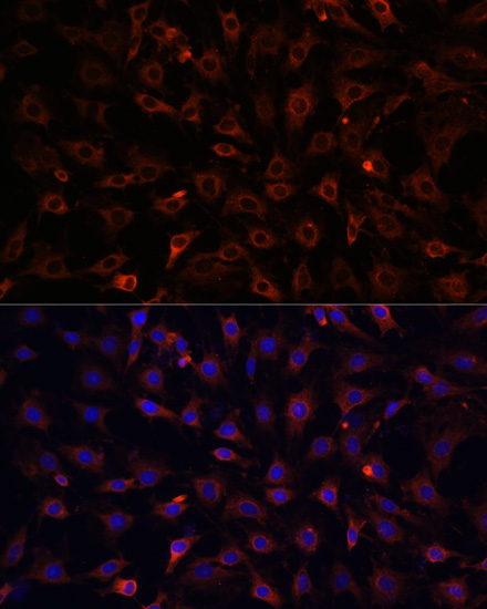 Immunofluorescence analysis of C6 cells using MyD88 Polyclonal Antibody at dilution of  1:100. Blue: DAPI for nuclear staining.