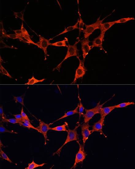 Immunofluorescence analysis of NIH/3T3 cells using MyD88 Polyclonal Antibody at dilution of  1:100. Blue: DAPI for nuclear staining.