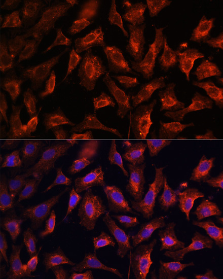 Immunofluorescence analysis of U2OS cells using MyD88 Polyclonal Antibody at dilution of  1:100. Blue: DAPI for nuclear staining.