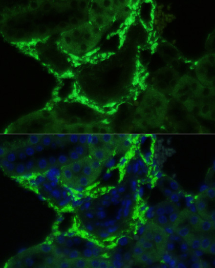 Immunofluorescence analysis of Mouse kidney using COL1A1 Polyclonal Antibody at dilution of  1:100. Blue: DAPI for nuclear staining.