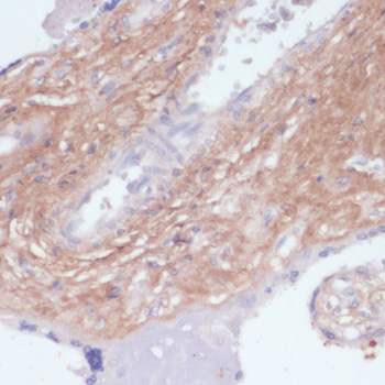 Immunohistochemistry of paraffin-embedded Human placenta using COL1A1 Polyclonal Antibody at dilution of  1:200 (40x lens).