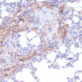 Immunohistochemistry of paraffin-embedded Mouse lung using COL1A1 Polyclonal Antibody at dilution of  1:200 (40x lens).