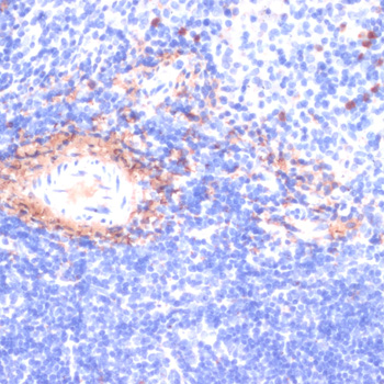 Immunohistochemistry of paraffin-embedded Mouse spleen using COL1A1 Polyclonal Antibody at dilution of  1:200 (40x lens).