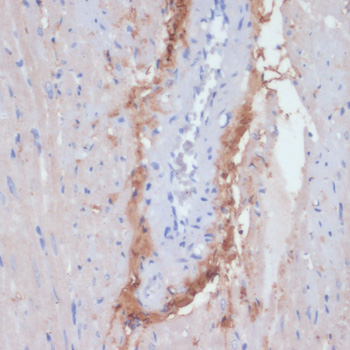 Immunohistochemistry of paraffin-embedded Rat heart using COL1A1 Polyclonal Antibody at dilution of  1:200 (40x lens).