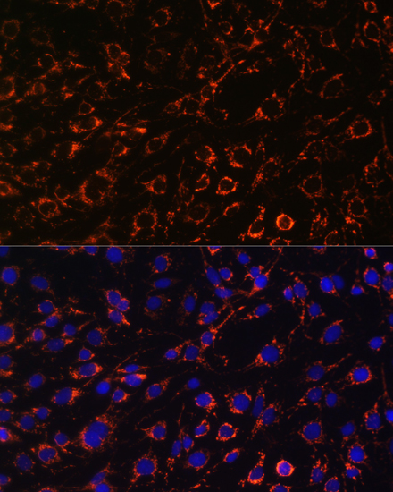 Immunofluorescence analysis of C6 cells using TOM20 Polyclonal Antibody at dilution of  1:100. Blue: DAPI for nuclear staining.