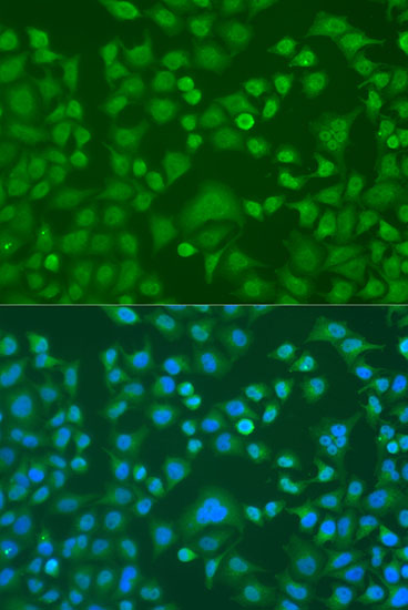 Immunofluorescence analysis of U2OS cells using EWSR1 Polyclonal Antibody at dilution of  1:100. Blue: DAPI for nuclear staining.