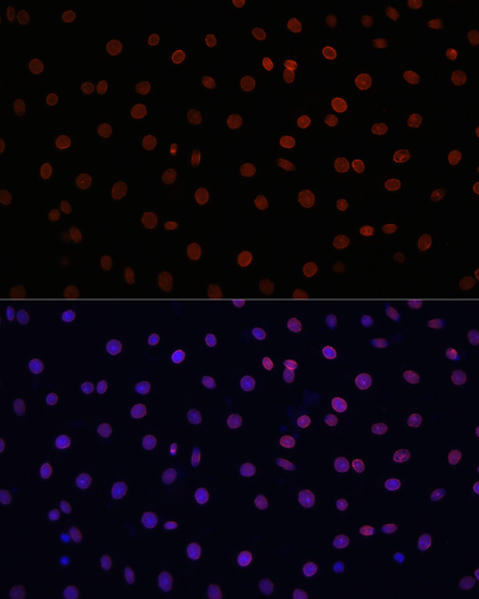 Immunofluorescence analysis of C6 cells using LMNB1 Polyclonal Antibody at dilution of  1:100. Blue: DAPI for nuclear staining.