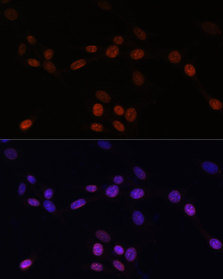 Immunofluorescence analysis of NIH/3T3 cells using LMNB1 Polyclonal Antibody at dilution of  1:100. Blue: DAPI for nuclear staining.