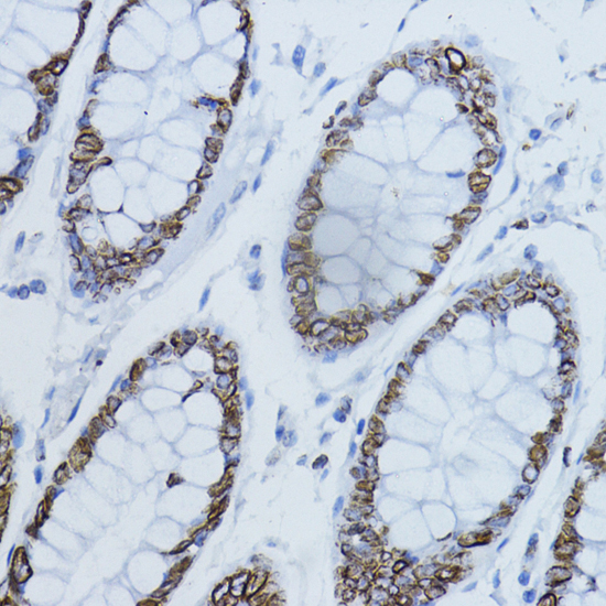 Immunohistochemistry of paraffin-embedded Human colon using LMNB1 Polyclonal Antibody at dilution of  1:200 (40x lens).