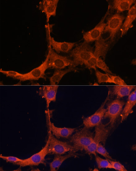 Immunofluorescence analysis of C6 cells using SMAD2 Polyclonal Antibody at dilution of  1:100. Blue: DAPI for nuclear staining.