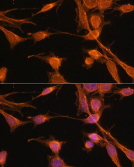 Immunofluorescence analysis of NIH-3T3 cells using SMAD2 Polyclonal Antibody at dilution of  1:100. Blue: DAPI for nuclear staining.