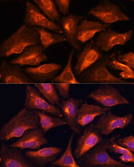 Immunofluorescence analysis of U-2 OS cells using SMAD2 Polyclonal Antibody at dilution of  1:100. Blue: DAPI for nuclear staining.