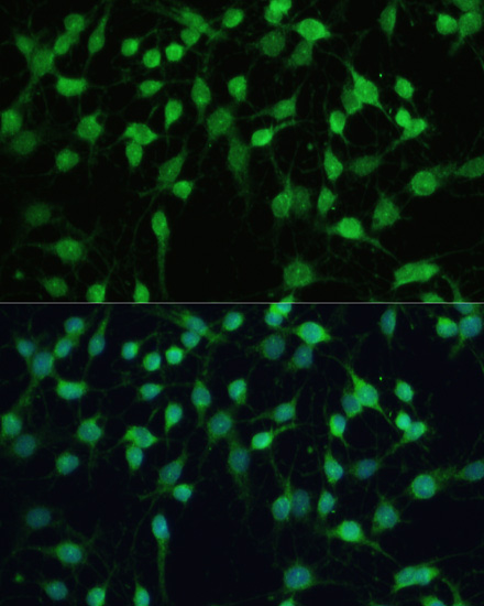 Immunofluorescence analysis of C6 cells using SMAD2 Polyclonal Antibody at dilution of  1:100. Blue: DAPI for nuclear staining.