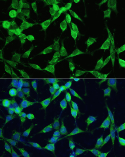 Immunofluorescence analysis of NIH-3T3 cells using SMAD2 Polyclonal Antibody at dilution of  1:100. Blue: DAPI for nuclear staining.