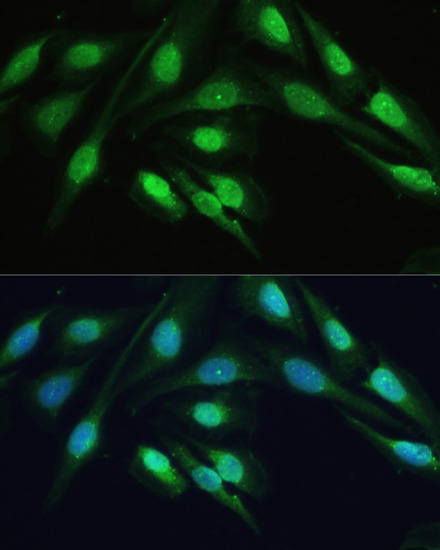 Immunofluorescence analysis of U-2 OS cells using SMAD2 Polyclonal Antibody at dilution of  1:100. Blue: DAPI for nuclear staining.