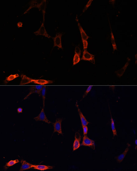 Immunofluorescence analysis of NIH/3T3 cells using NFKBIA Polyclonal Antibody at dilution of  1:100. Blue: DAPI for nuclear staining.