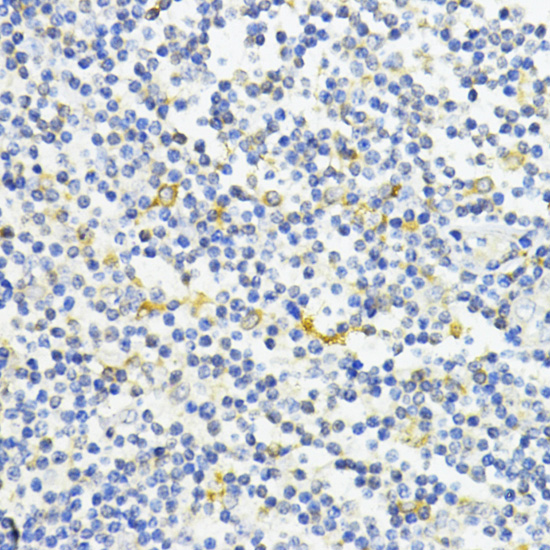 Immunohistochemistry of paraffin-embedded Human tonsil using AMPKα1 Polyclonal Antibody at dilution of  1:200 (40x lens).