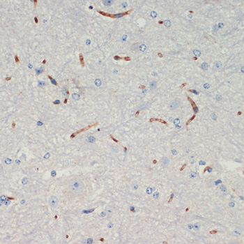 Immunohistochemistry of paraffin-embedded Mouse spinal cord using THBS1 Polyclonal Antibody at dilution of  1:200 (40x lens).