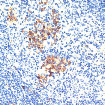 Immunohistochemistry of paraffin-embedded Mouse spleen using THBS1 Polyclonal Antibody at dilution of  1:200 (40x lens).