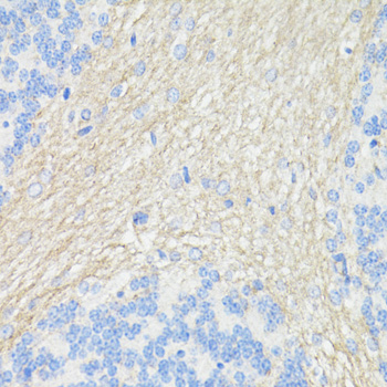 Immunohistochemistry of paraffin-embedded Rat brain using THY1 Polyclonal Antibody at dilution of  1:100 (40x lens).