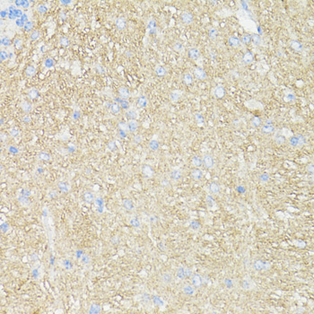 Immunohistochemistry of paraffin-embedded Mouse brain using THY1 Polyclonal Antibody at dilution of  1:100 (40x lens).