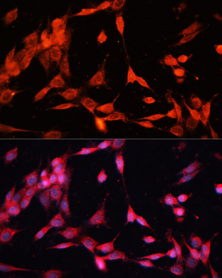 Immunofluorescence analysis of NIH-3T3 cells using TRAF6 Polyclonal Antibody at dilution of  1:100 (40x lens). Blue: DAPI for nuclear staining.