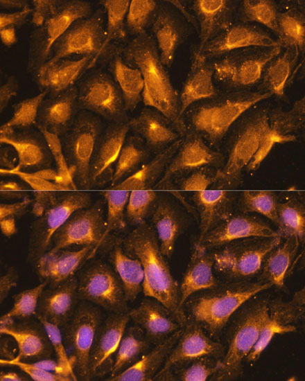 Immunofluorescence analysis of U-2 OS cells using TRAF6 Polyclonal Antibody at dilution of  1:100 (40x lens). Blue: DAPI for nuclear staining.