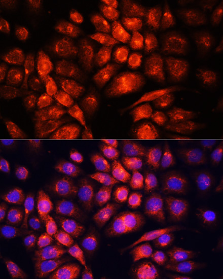 Immunofluorescence analysis of HeLa cells using UCP3 Polyclonal Antibody at dilution of  1:100. Blue: DAPI for nuclear staining.