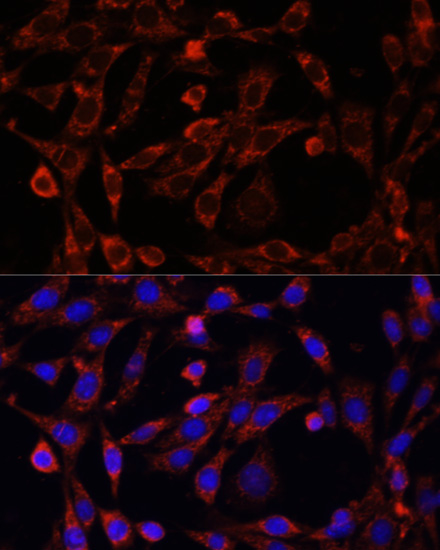 Immunofluorescence analysis of NIH/3T3 cells using UCP3 Polyclonal Antibody at dilution of  1:100. Blue: DAPI for nuclear staining.