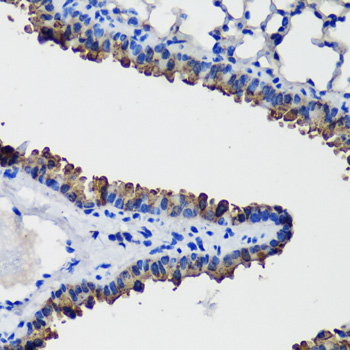 Immunohistochemistry of paraffin-embedded Mouse lung using SCGB1A1 Polyclonal Antibody at dilution of  1:100 (40x lens).