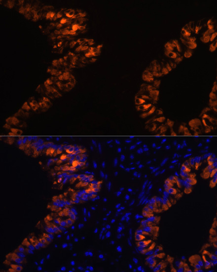 Immunofluorescence analysis of Mouse lung cells using SCGB1A1 Polyclonal Antibody at dilution of  1:100. Blue: DAPI for nuclear staining.