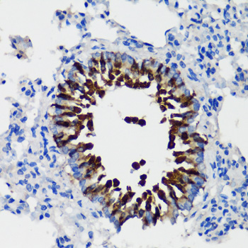 Immunohistochemistry of paraffin-embedded Rat lung using SCGB1A1 Polyclonal Antibody at dilution of  1:100 (40x lens).